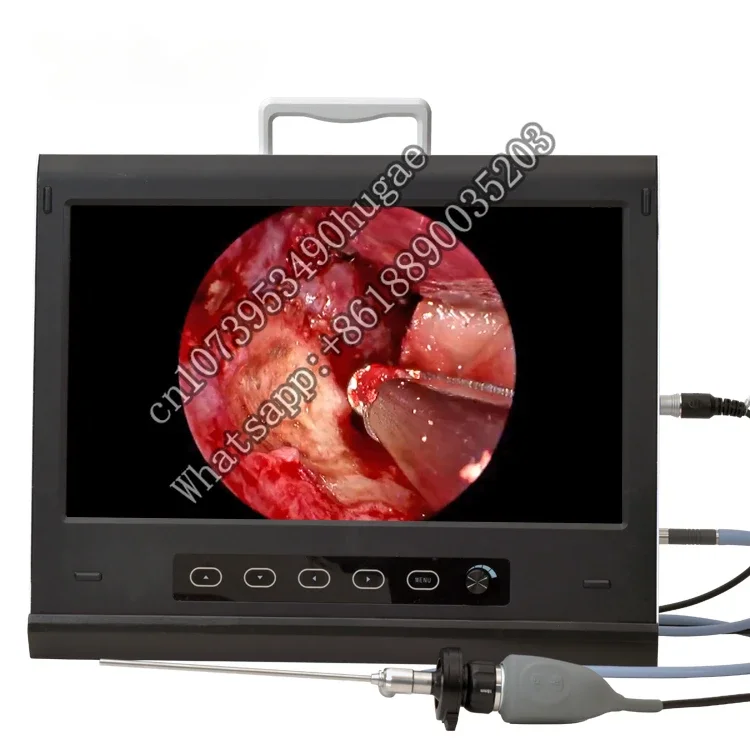 YKD-9119 Light Source Integrated HD Endoscopy  for Spine Surgery