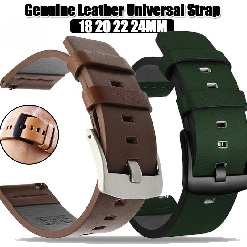 20Mm 22Mm Watch Ban… - image