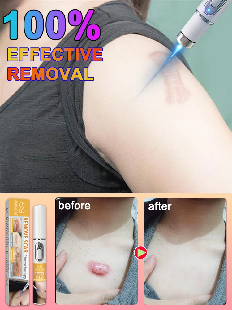 

2025 Последние технологии для глубокой реконструкции различных новых и старых шрамов.