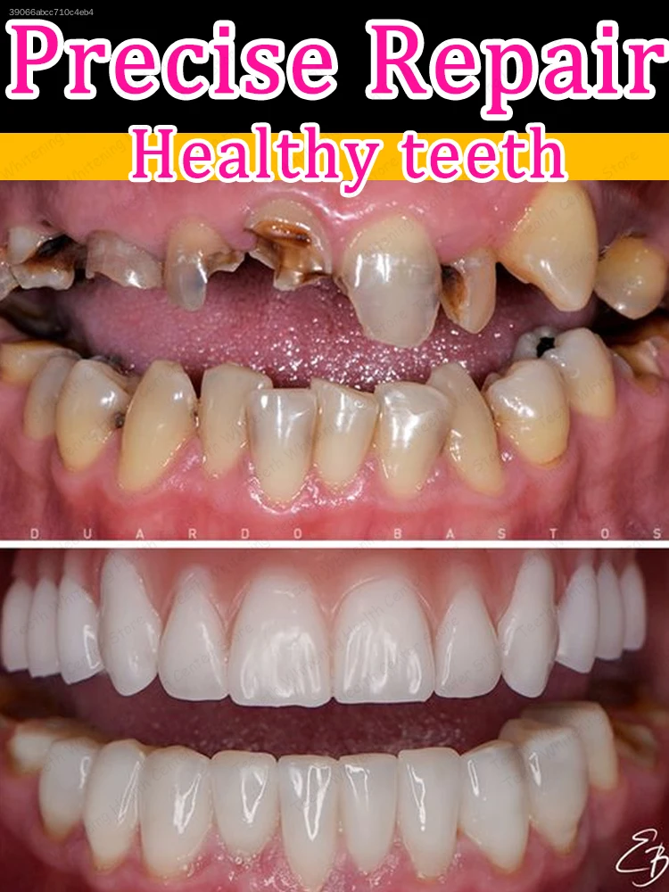 Избавьтесь от кариеса Brush your teeth regularly to maintain dental health