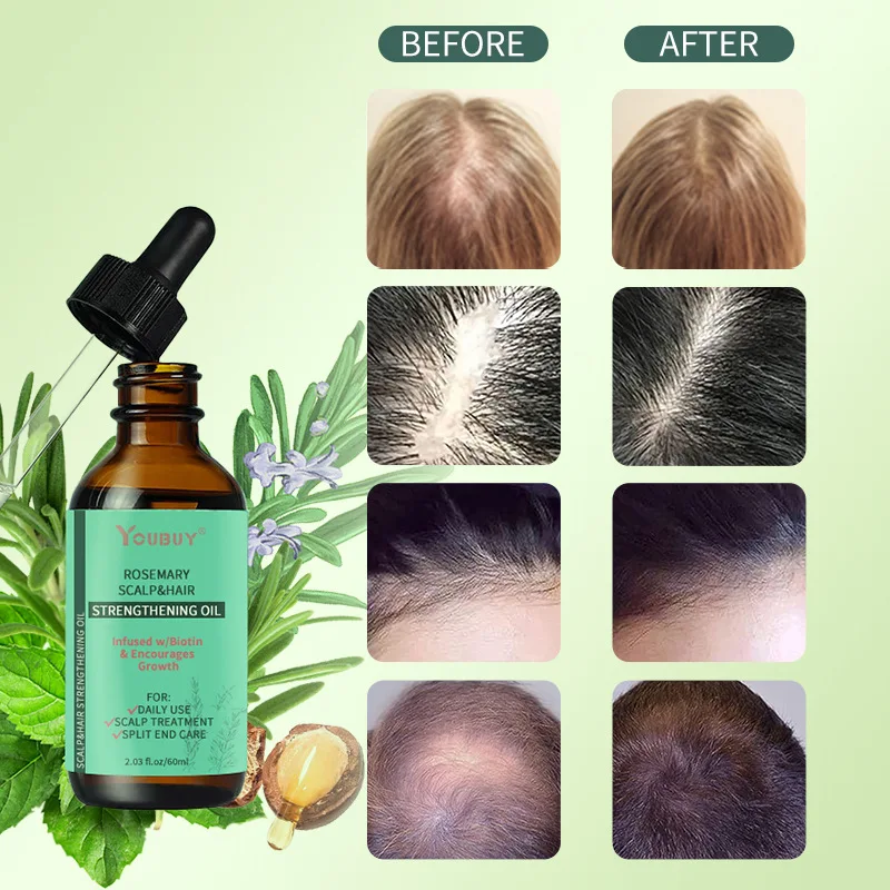 

60ml Professional Hair Scalp Nourishing Oil for Frizz-Free, Glossy Hair, Enhances Hair Growth Refreshing Hair Treatment Serum