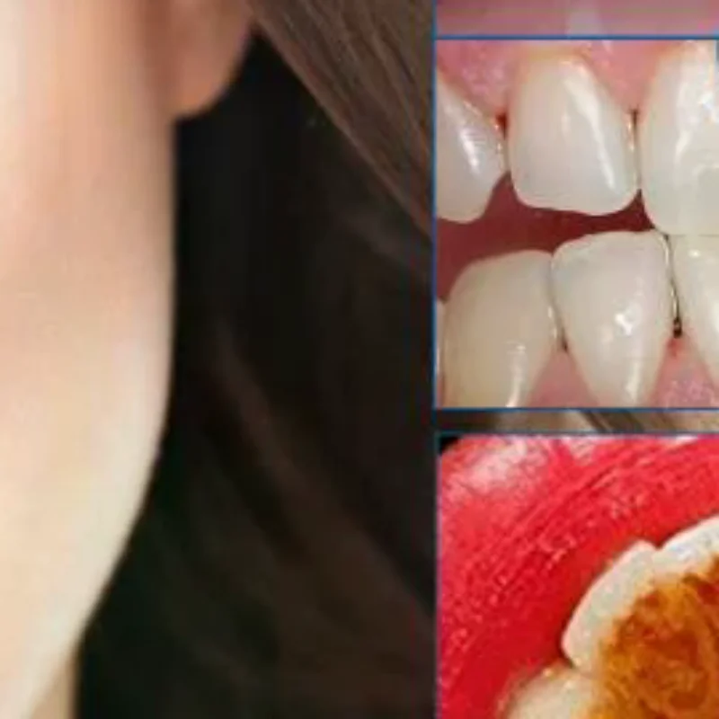

Damaged Gum Repair Care Gel Relieve Sore Gums Allergy Deep Cleaning Teeth Stains Tartar Serum Dental Caries Toothpaste