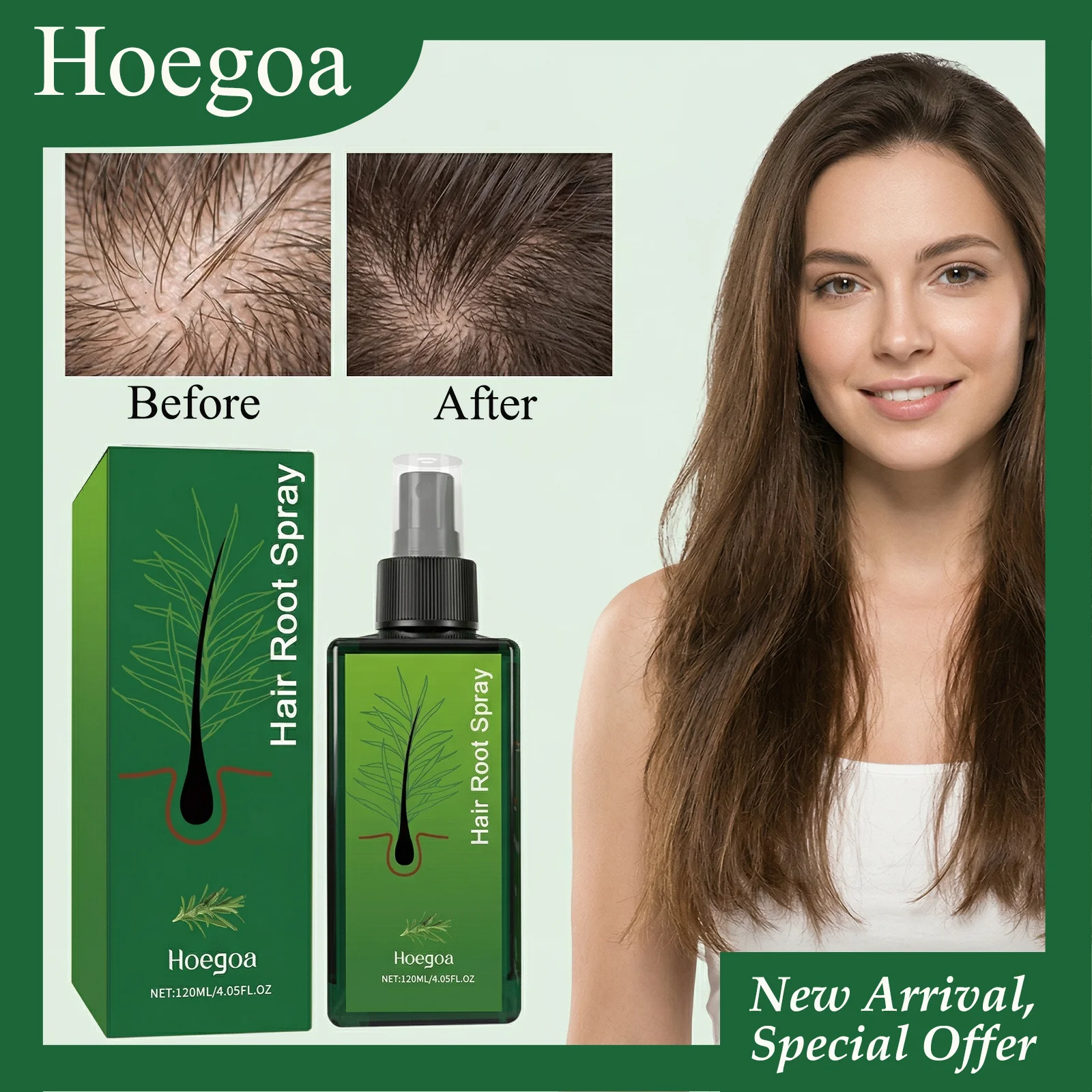 HOEGOA 120mL Haarwurzelspray schützt die Kopfhaut, spendet Feuchtigkeit und reduziert trockenes und krauses Haar, repariert geschädigte Kopfhaut, Haarpflegespray.