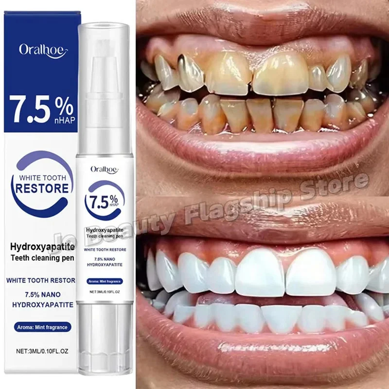 

Magical Teeth Whitening Pen Effectively Removes Dental Plaque Coffee Stains Smoke Stains Freshens Breath Teeth Whitening Care