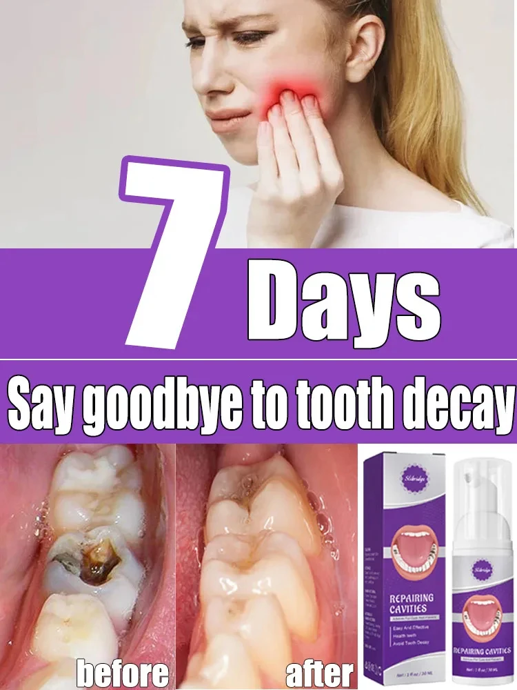 decay Tooth Repair Repairing Cavities Protect Anti caries