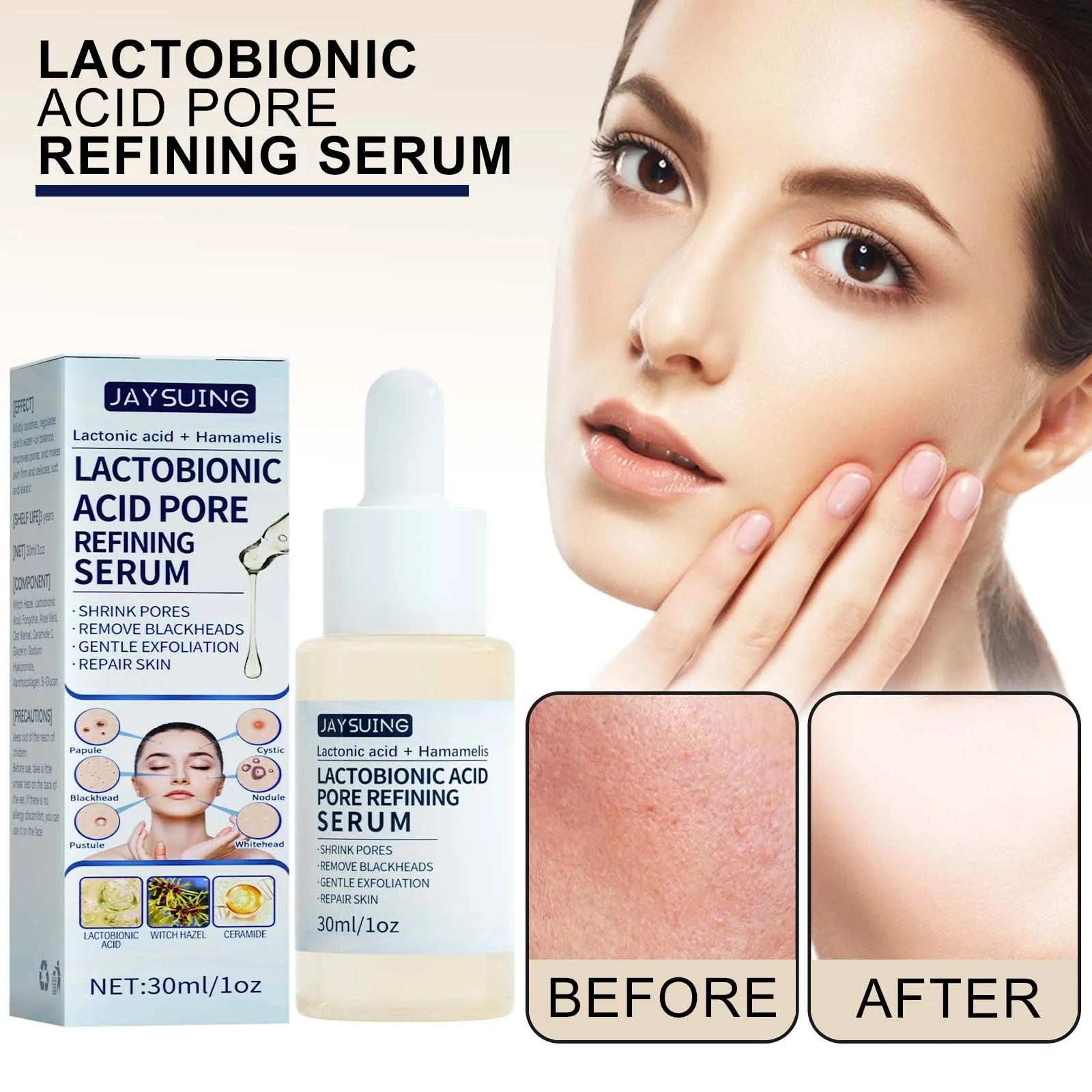 

1-4PCS Lactic Acid Serum Exfoliator for Blackhead Removal Pore Minimizer Skin Brightening Treatment for Smooth Glowing Skin Care