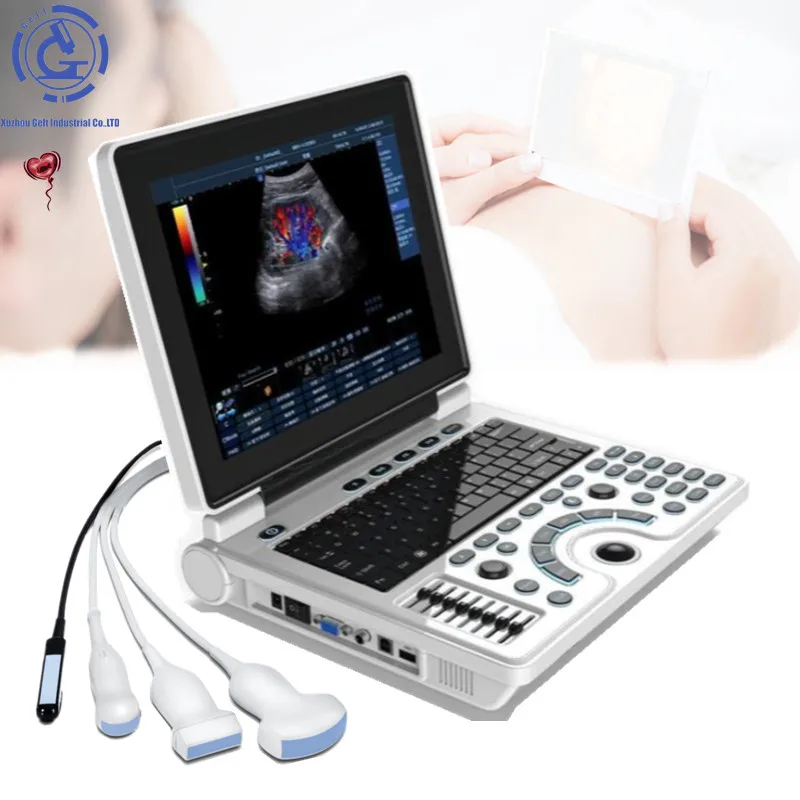 

Notebook B/W Ultrasound Machine Ultrasonido Ecografo Portatil China