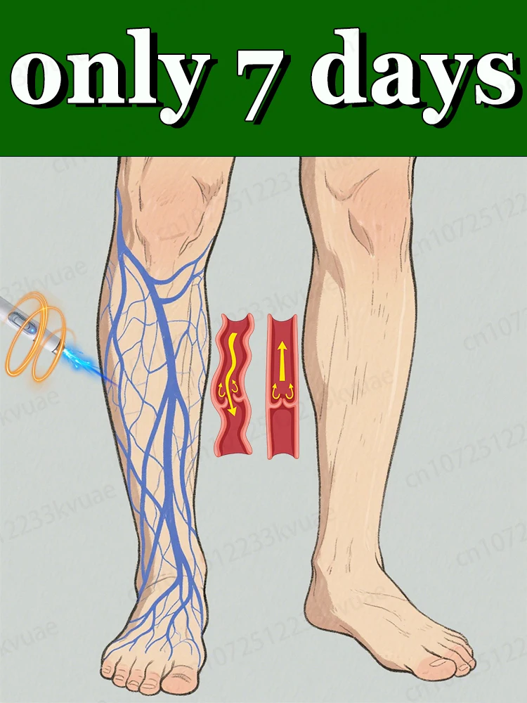 

Blue light varicose vein tool, more discounts for sets