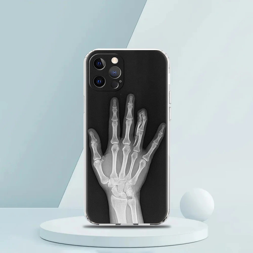 غطاء هاتف شفاف لهاتف iPhone 16,15,14,13,12,11,Pro,Max,8,7,Plus,16E,XS,Max Soft TPU Shell Autumu X Ray حقيبة عظام اليد