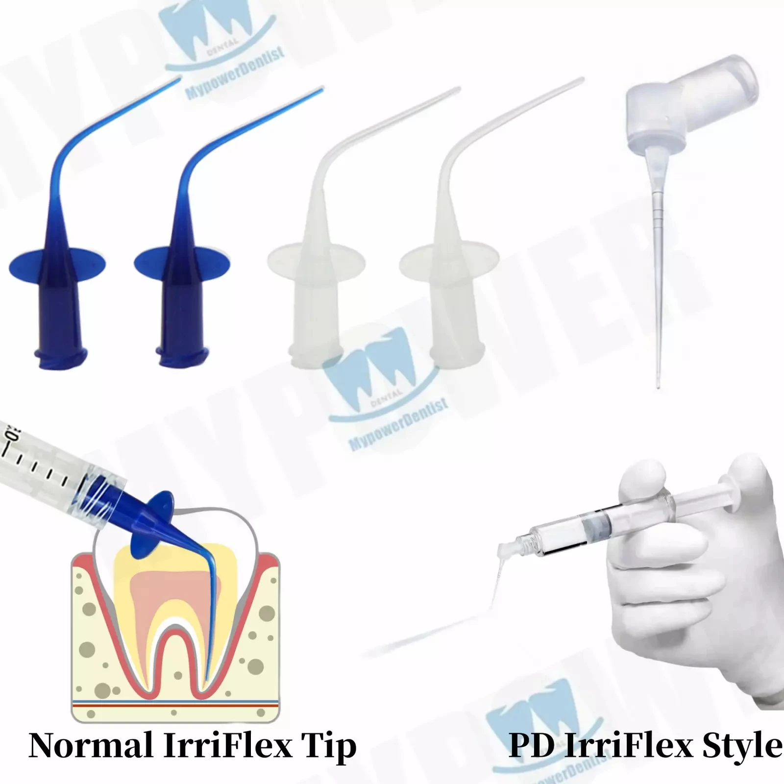 Dental Endodontic Endo Irrigation Needle Tip Disposable Root Canal Syringe Tips