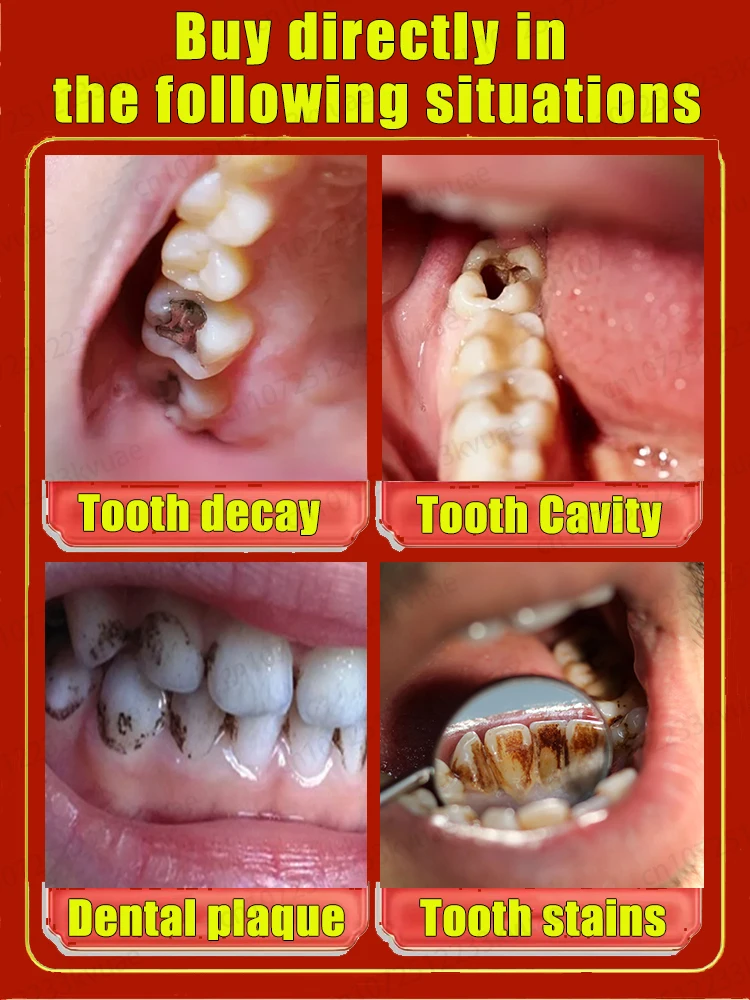 Repair cavities and prevent cavities for a confident smile