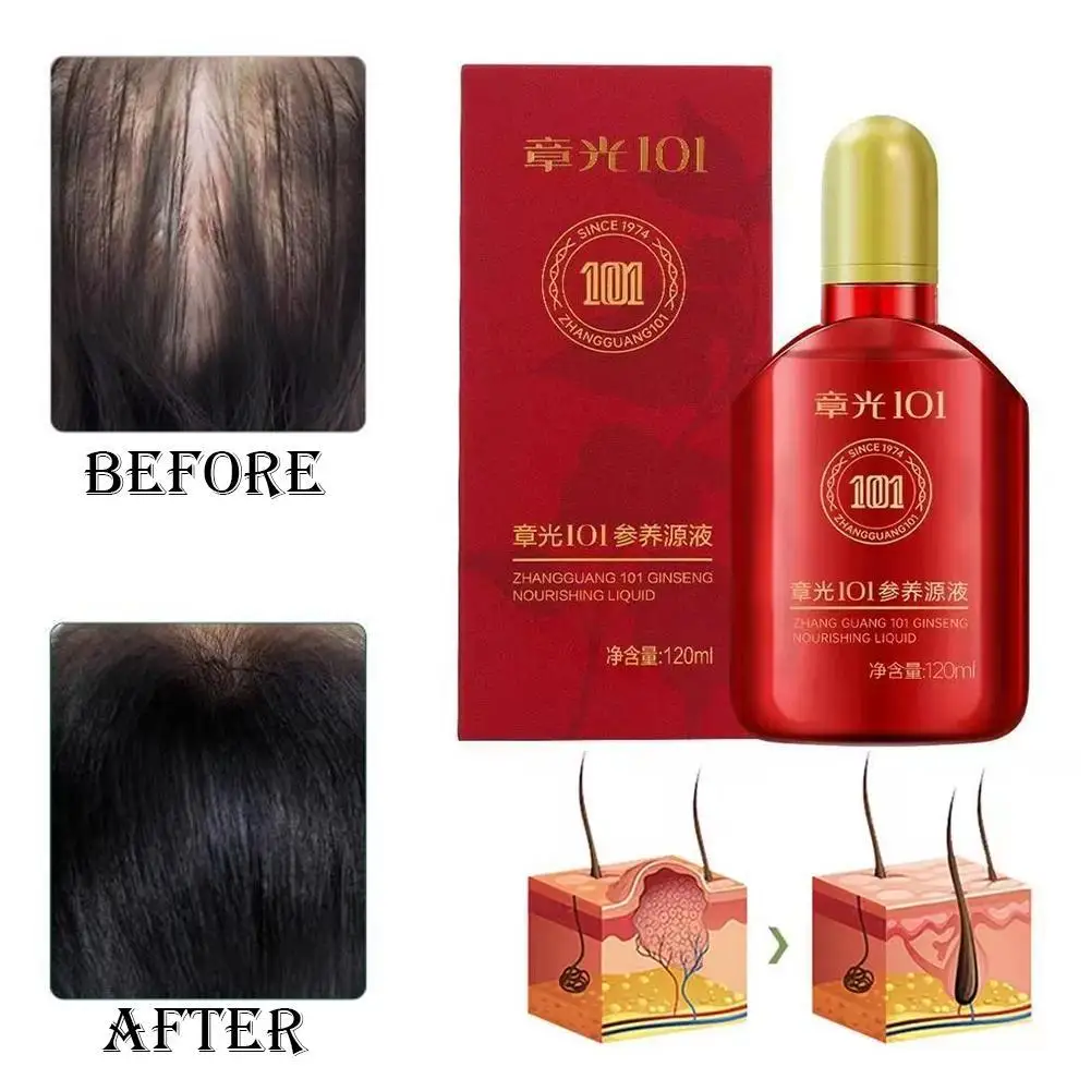 

120 мл средство против выпадения волос, питательная сыворотка для восстановления фолликулов, уход за кожей головы для мужчин и женщин