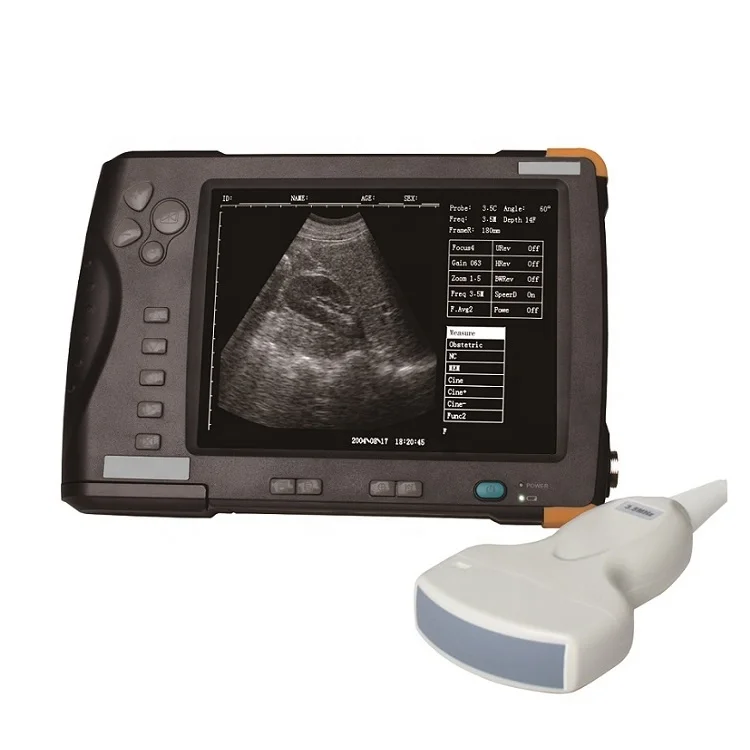 Handheld farm ultrasound scanner for cattle, horses, sheep, dogs, cats, goats, pigs, camels, pregnant cattle ultrasound machine