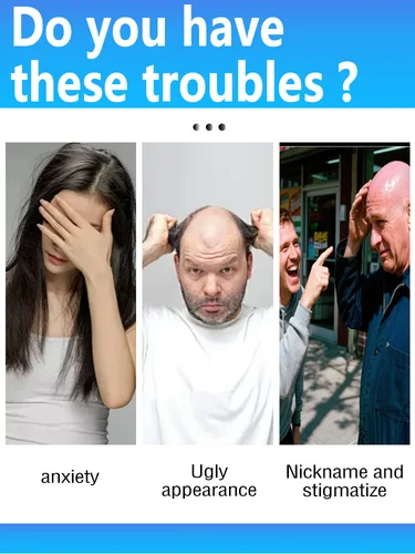 Imagen 2 del producto 2025, nuevo actualizado, aplicador de cuero cabelludo, peine líquido para el tratamiento del cuero cabelludo, masajeador guía líquido, aceite de suero para el crecimiento del cabello.