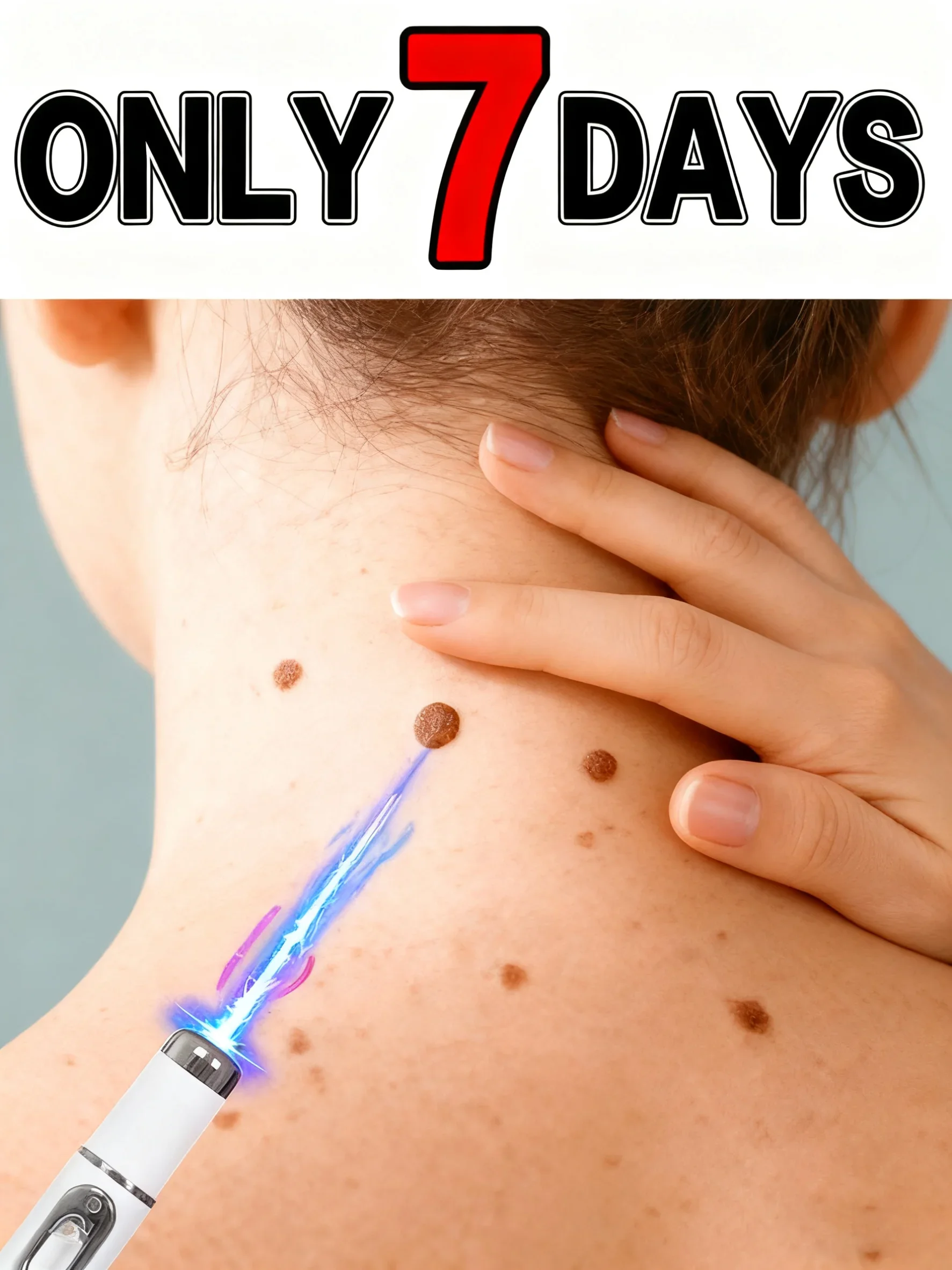 

Самая продаваемая ручка с синим светом: эффективно для удаления бородавок и ухода за бородавками на теле.