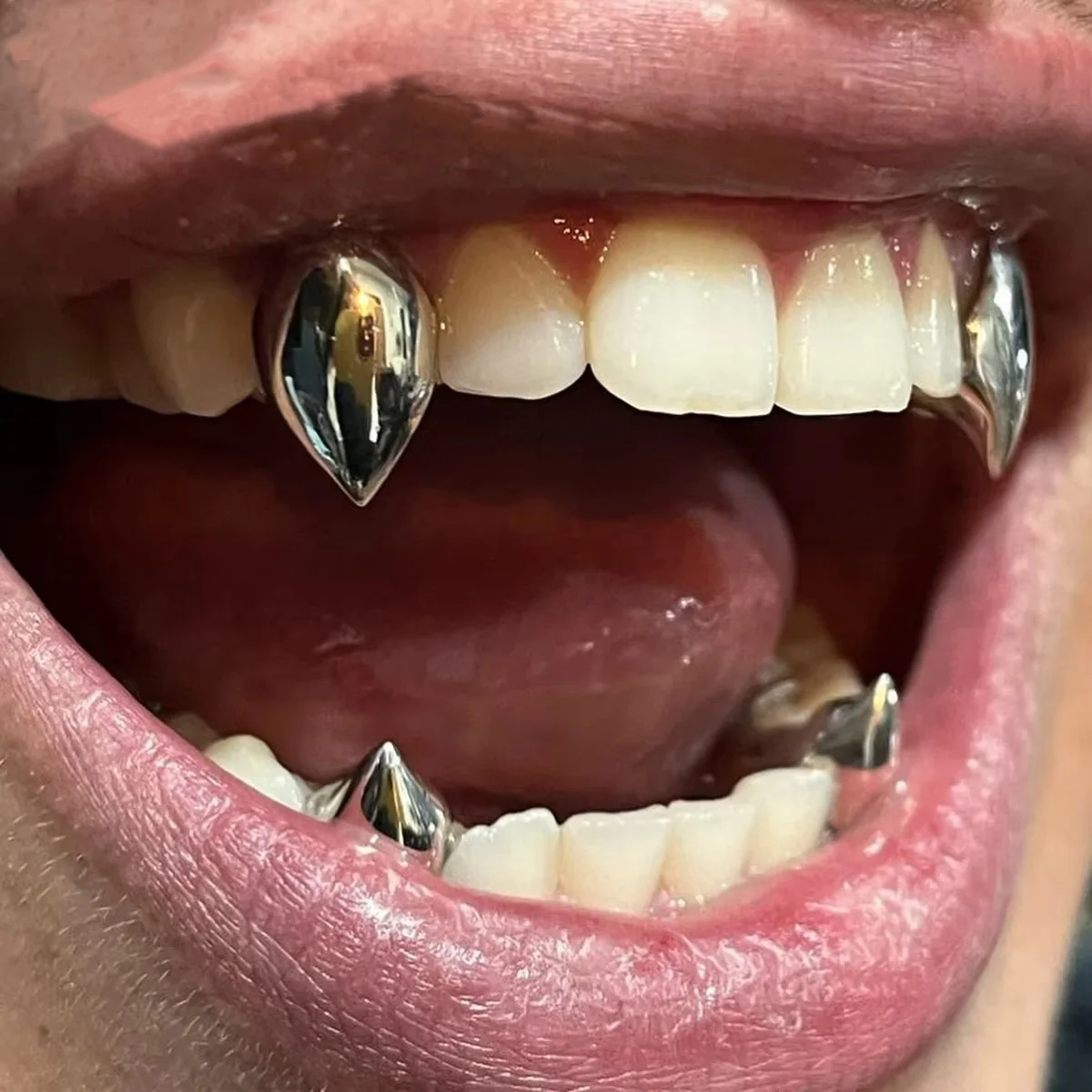 YOUNGX Hot Hip Hop Water Drop Teeth Grillz 14K Real Gold Plated Tooth Caps For Women Men Jewelry Vampire Fangs
