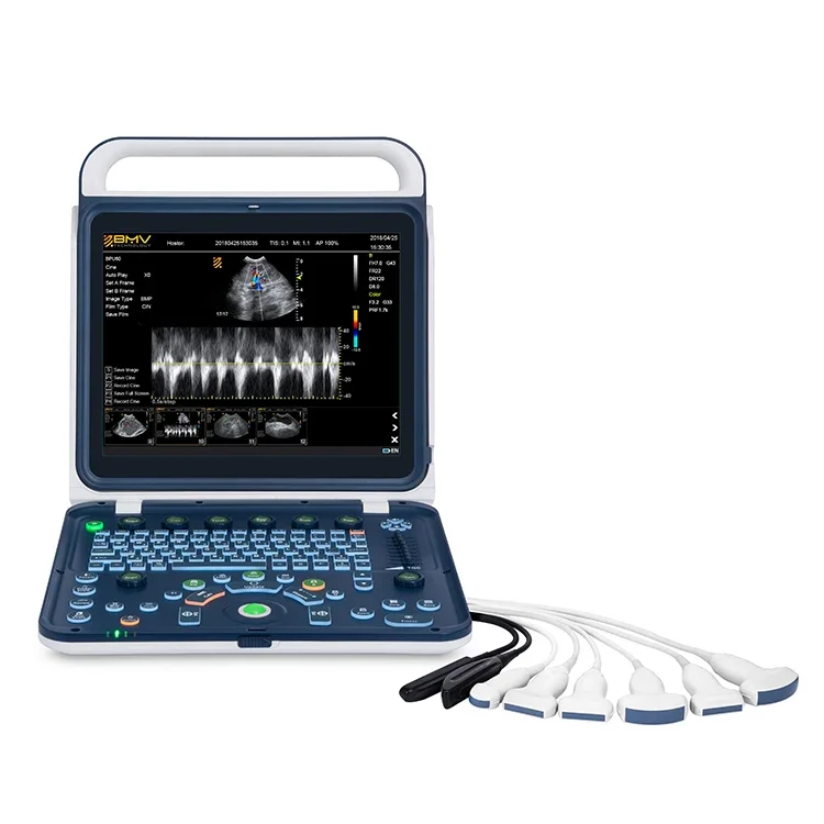 

Color Doppler Ultrasound machine Animal ultrasound diagnostic system Ultrasonic diagnosis medical imaging Veterinary equipment