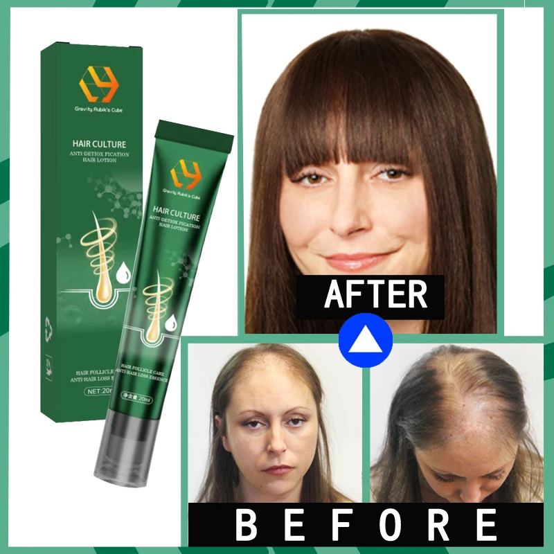 Hair Tonic hair growth Alopecia areata bald