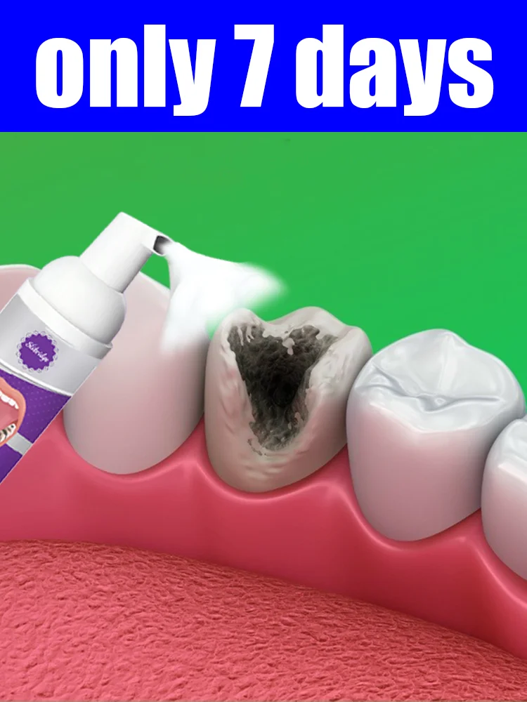 Unisex, kostenloser Versand, Mousse löst verschiedene Probleme Intraorale Pflegewerkzeuge