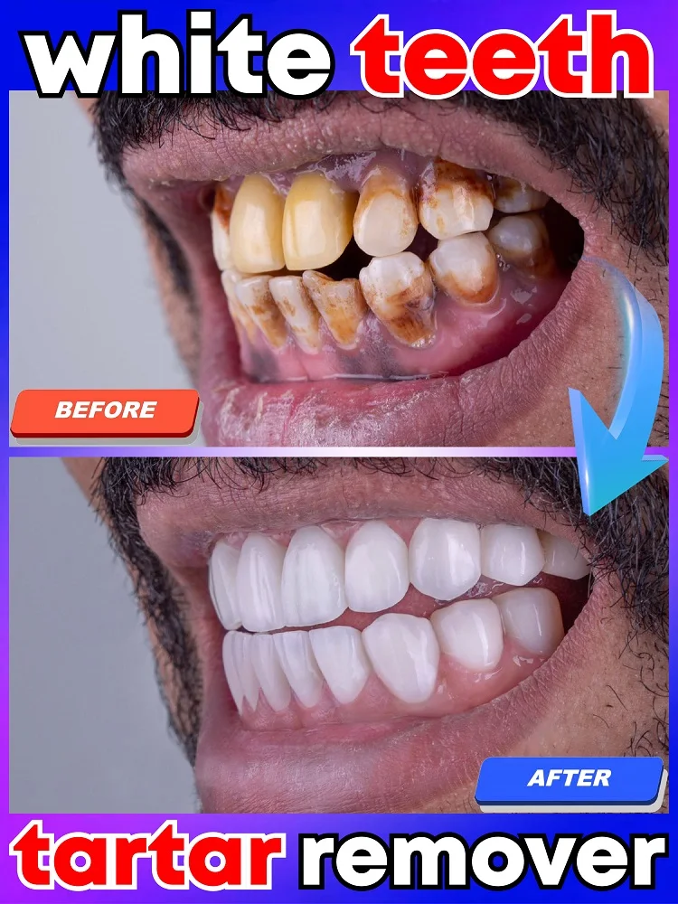 

The latest research and development technology tooth mineral powder, effectively whitens and cleans dental plaque