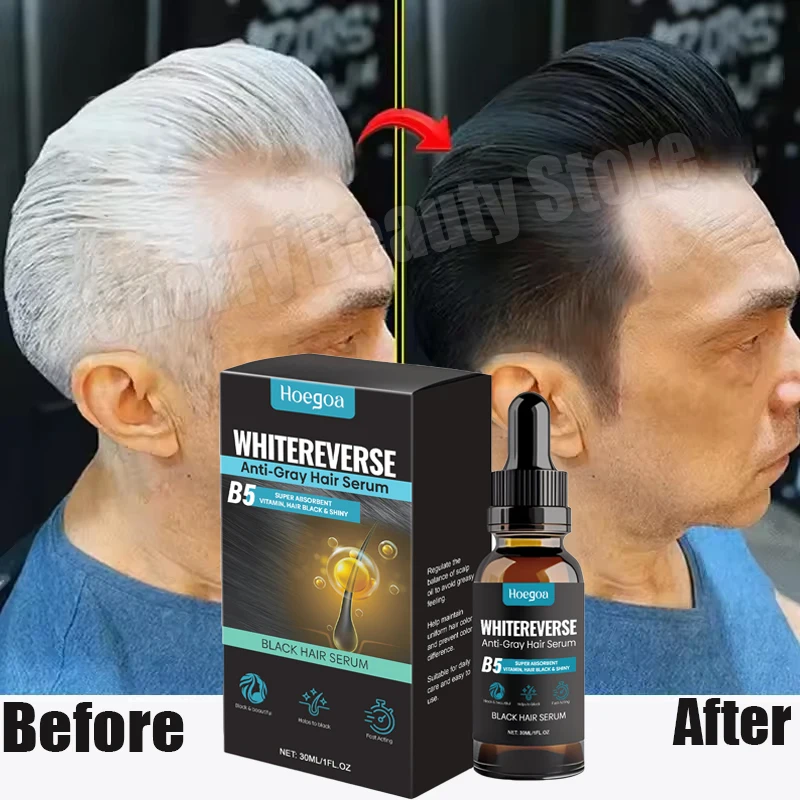 

Gray White Hair Treatment Serum Cover White Hair To Black Natural Color Repair Anti Loss Hair Restore Healthy HairCare Men Women