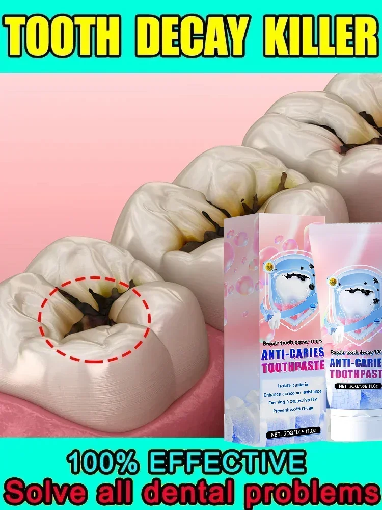 

Probiotic Toothpaste Whiten Tooth Remove Plaque Stains Oral Hygiene Clean Fresh Breath Protect Gum Teeth Care Products 2025