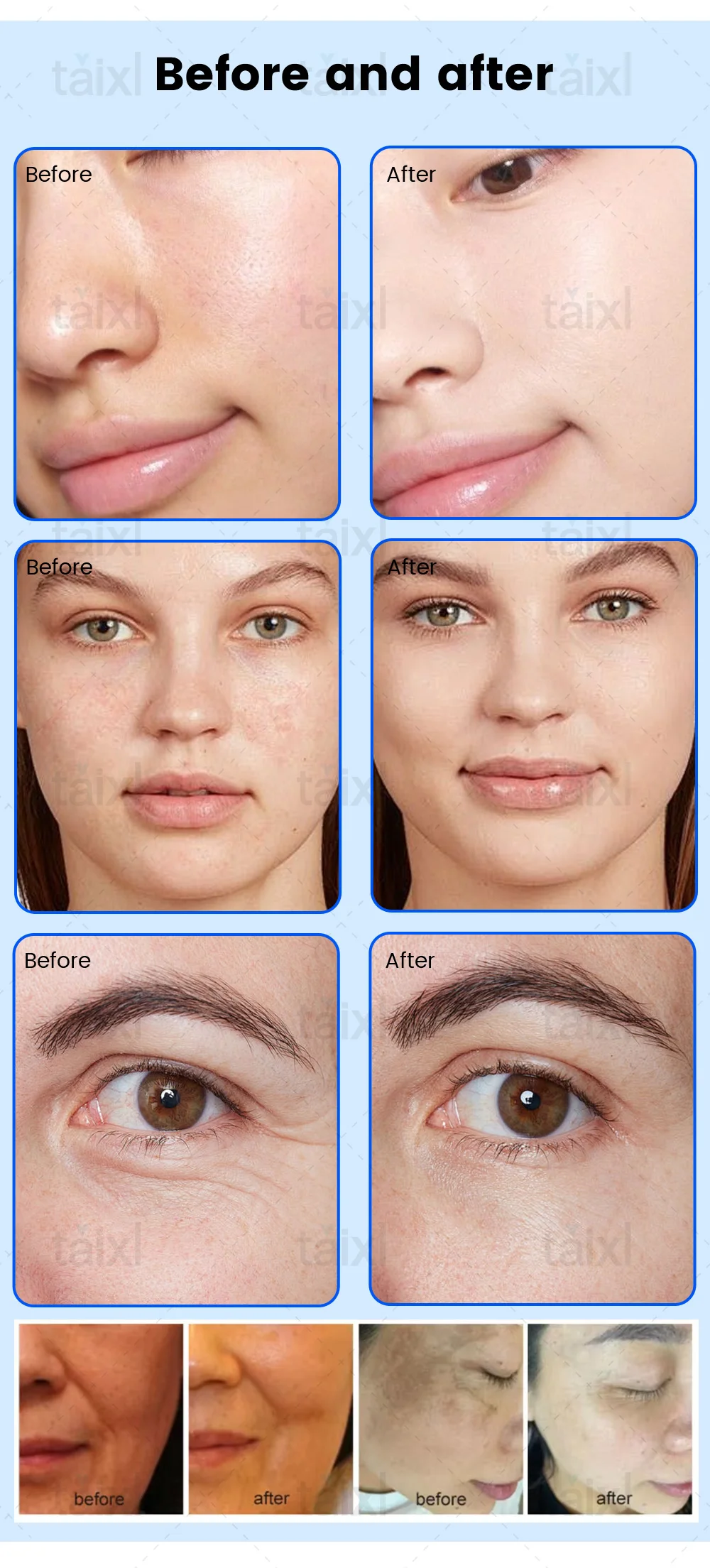 

Cold & Warm Plasma Aesthetic Equipment: Effectively Treats Pigmentation, Scars, Wrinkles, Acne, and Alopecia for Total Beauty Ca