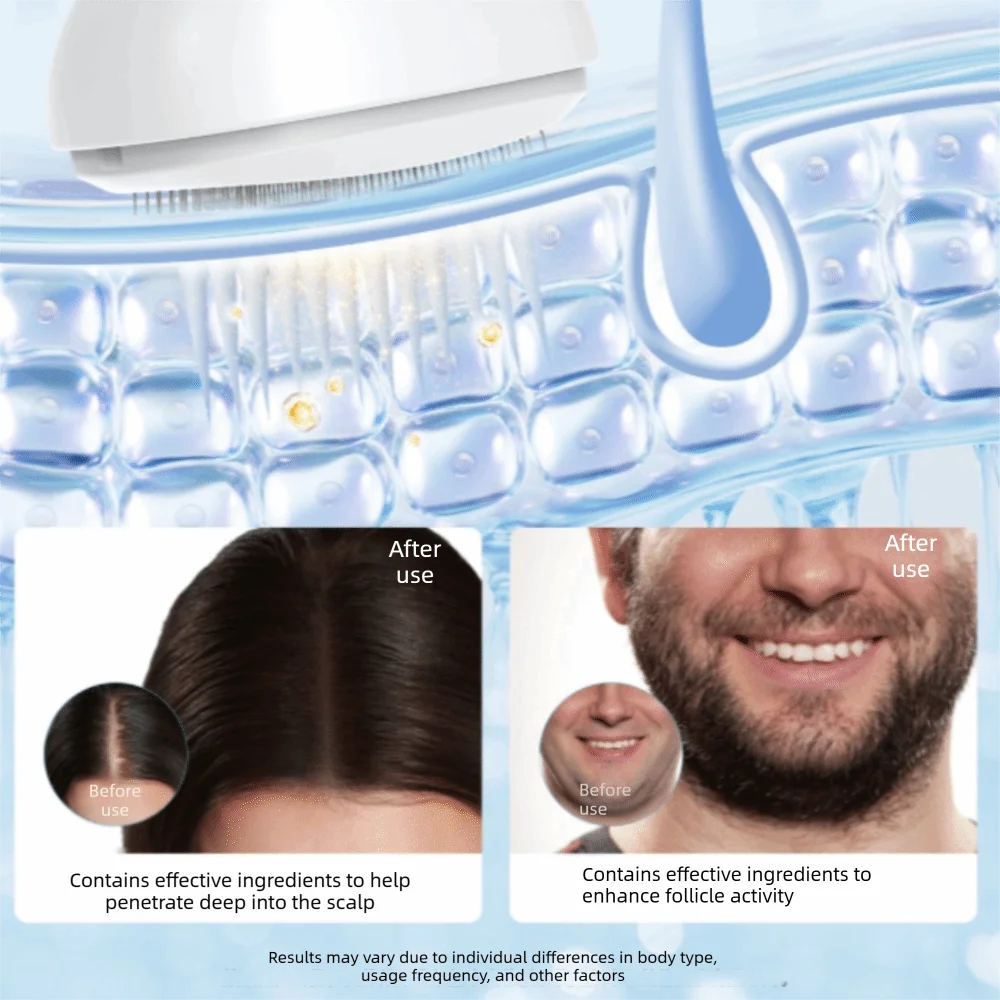 10ml Liquid Storage Scalp Serum Applicator Adjustable Needle Length 0.25mm Face Scalp Hair Beard Care Tool Press-to-release