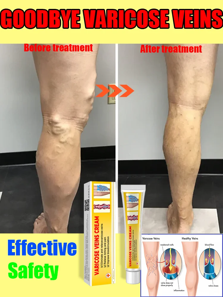 

Leg care nourishes customers with high repurchase rate and achieves perfect legs