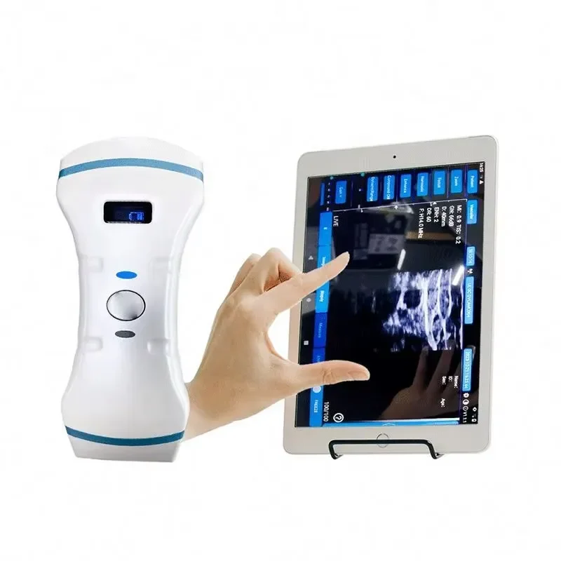 2026 New, High Quality, Handheld Double Head Diagnostic Scanner for Medical Imaging and Vascular
