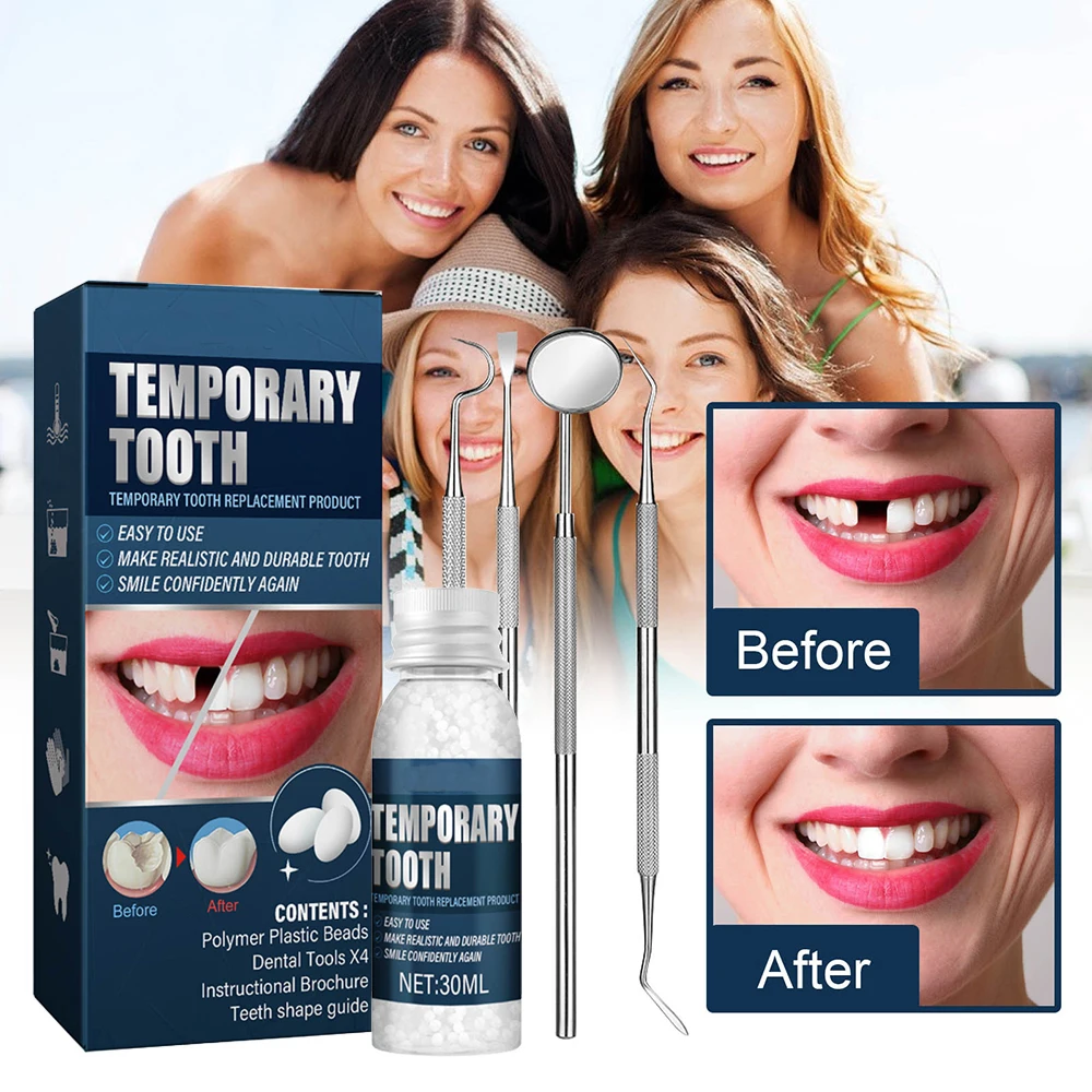 Oral Fake Teeth Filling Repair Temporary Tooth Filling Repair Kit Dental Repair Beads Food Grade False Teeth Solid Glue