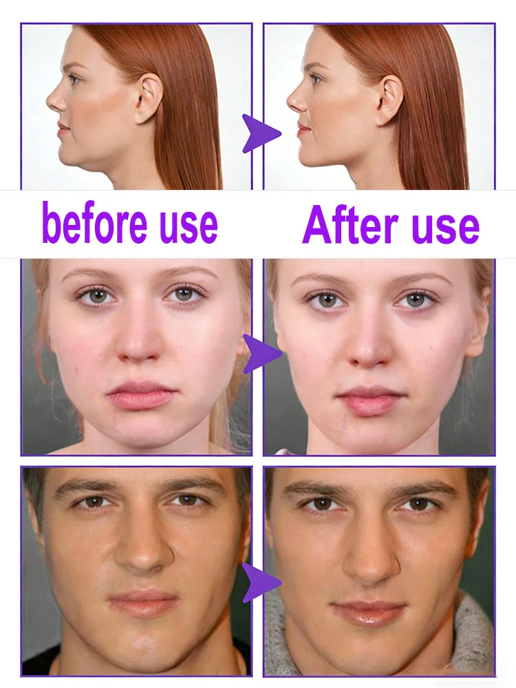 V shaped face cheek slimming  massage facial skin care