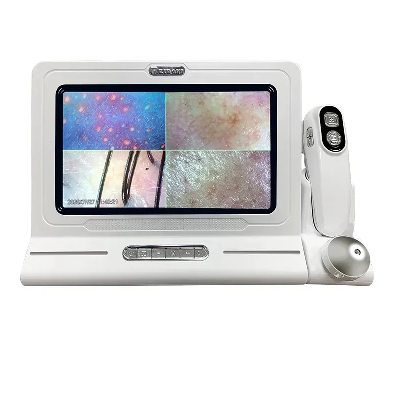 3D 11 Inch Screen Hair Diagnosis Analyzer S kin All in 1 Machine Four-Spectral UV Light Facial Skin Analyzer