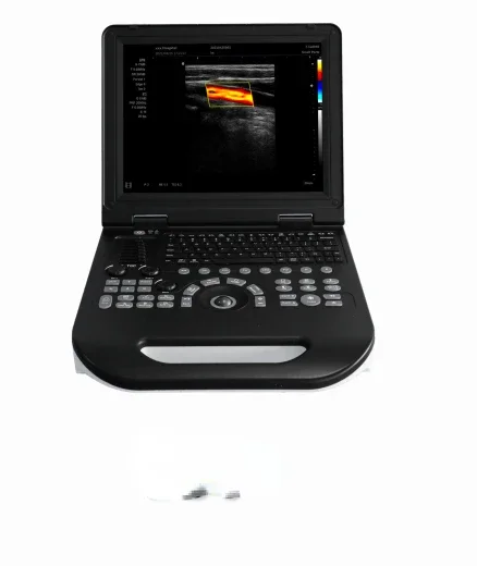 Direct sales Portable color ultrasound E30 with abdominal convex array probe