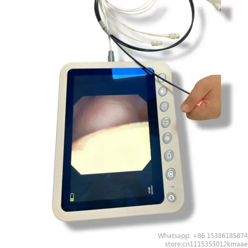 Vequyn All-in-One Veterinary Monitoring System: 720p Camera Processor, Waterproof, USB-Compatible with Bronchoscope