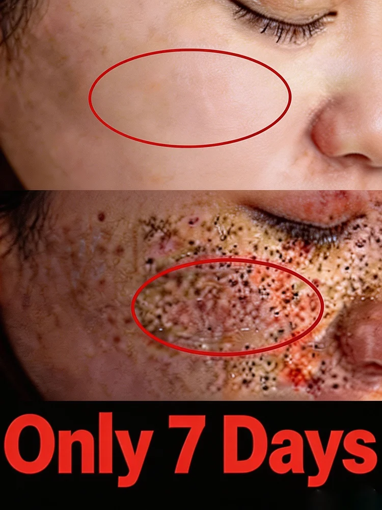 Solve facial skin problems; a best-selling product in 2026; gentle and effective; suitable for all skin types