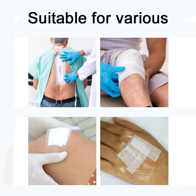 Non-Woven Breathable Tape Skin Healing Protective Soft Fabric Cloth Adhesive Antibacterial Wound Dressing Fixation Bandage