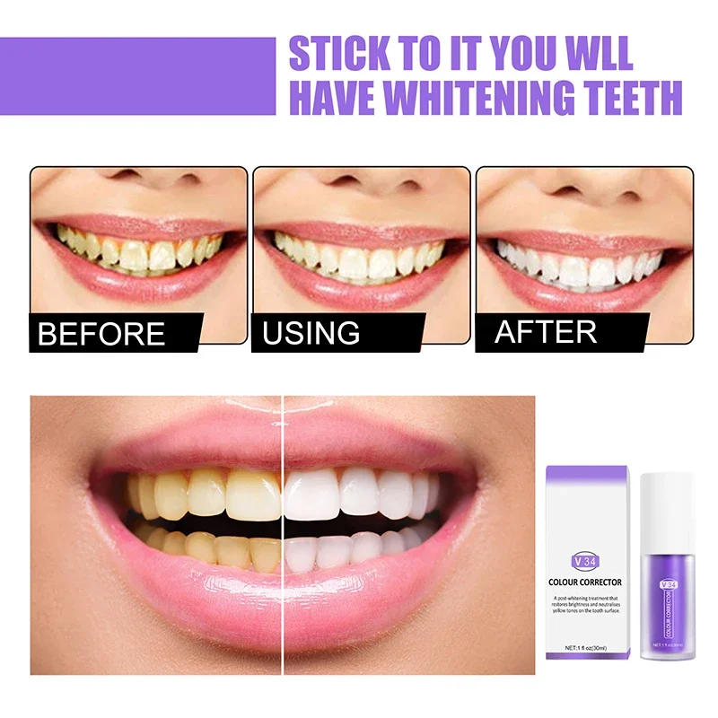 

New Sdottor V34 Purple Toothpaste Repair Teeth Repair Mouth Cleaning Dazzling White Remove Stains Oral Care Toothpaste Beauty He