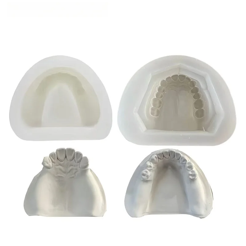 Dental Implant Teaching Model Maxillary Mandibular Sinus Model Soft Gums Teeth Model For Dentist Practice Studying Tools