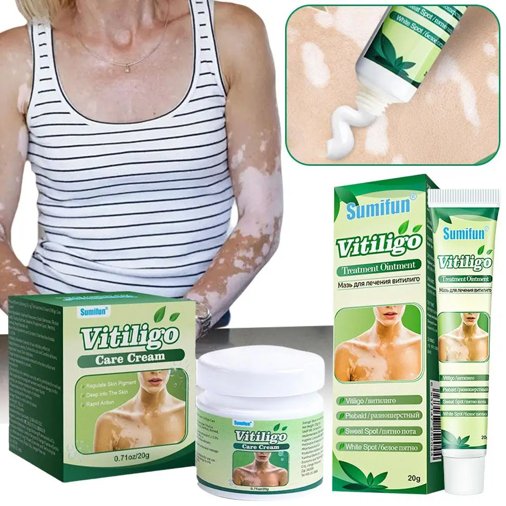 Vitiligo Ointment Herbal Extract Remove Ringworm White Skin Cream Vitiligo Eliminate Treatment Spot Vitiligo Removal C1P1