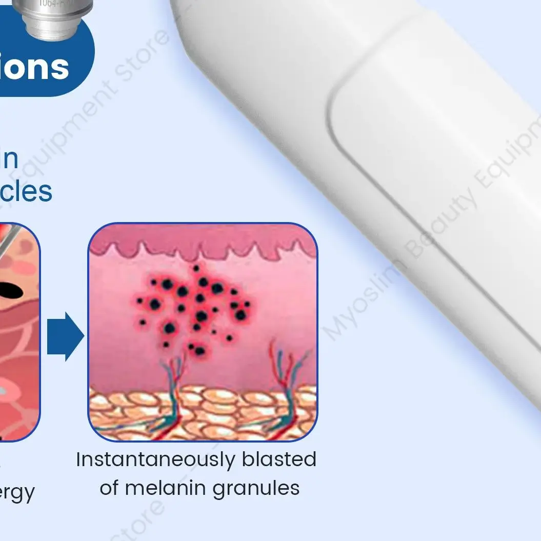 2 IN 1 Soprano Titanium Ice Platinum Diode and pico 755 808 940 1064nm 4 Wavelength Laser Hair Removal 4000W Machine Painless