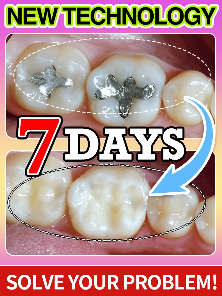 tooh Kariesreparatur Geeignet für alle Altersgruppen