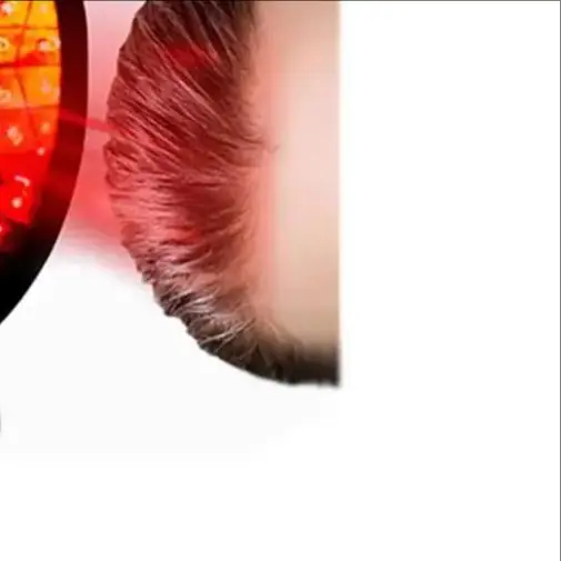 

HLKGO 96 Diode Laser Hair Regrowth Cap Clinical Strength LLLT Therapy For Genetic Hair Loss