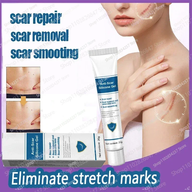 Stretch Mark Remover Permanent Stretch Mark Removerstretch marks remove scars