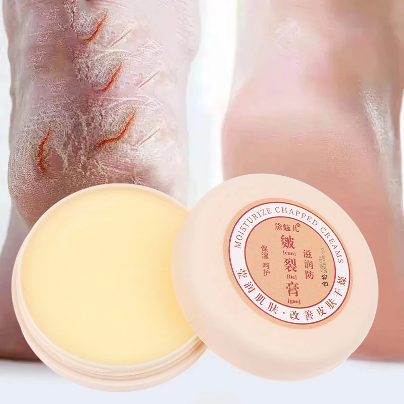 Crème réparatrice pour les pieds, 20g, huile anti-séchage, fissure au talon, élimination de la fréquence, soin de la peau, des mains et des pieds