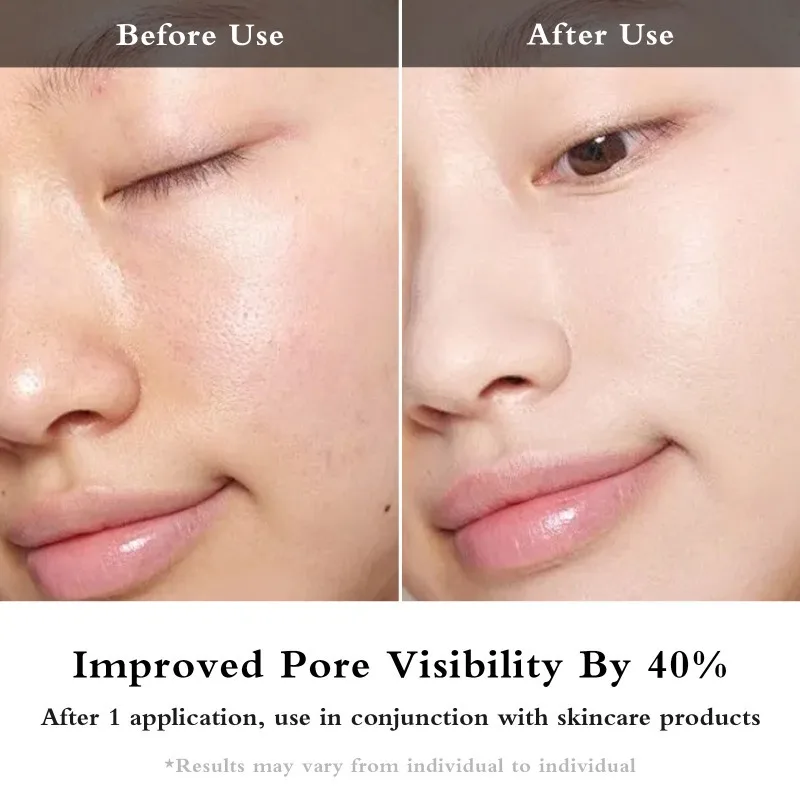 EMS Eye Massage Instrument Women Eyes Massage Device Dark Circles Removal Beauty Machine Eyes Fat Removal Skin Case Equipment