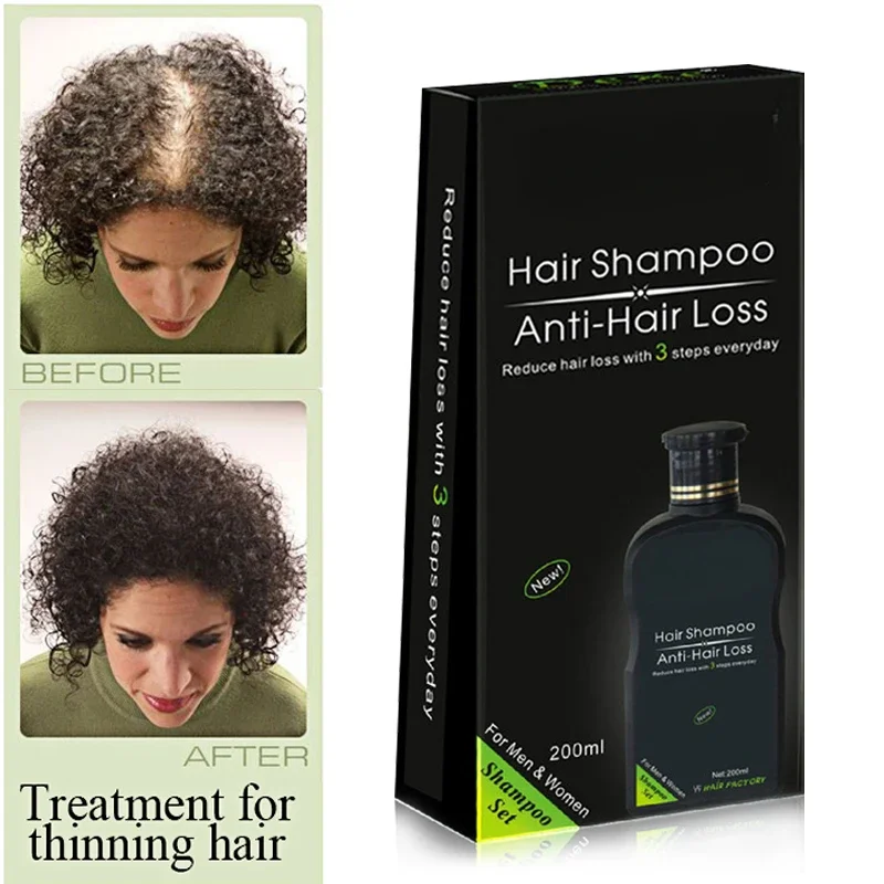 Professional Hair Growth Shampoo Anti-Hair Loss Chinese Hair Treatment Product for Preventing Hair Fall