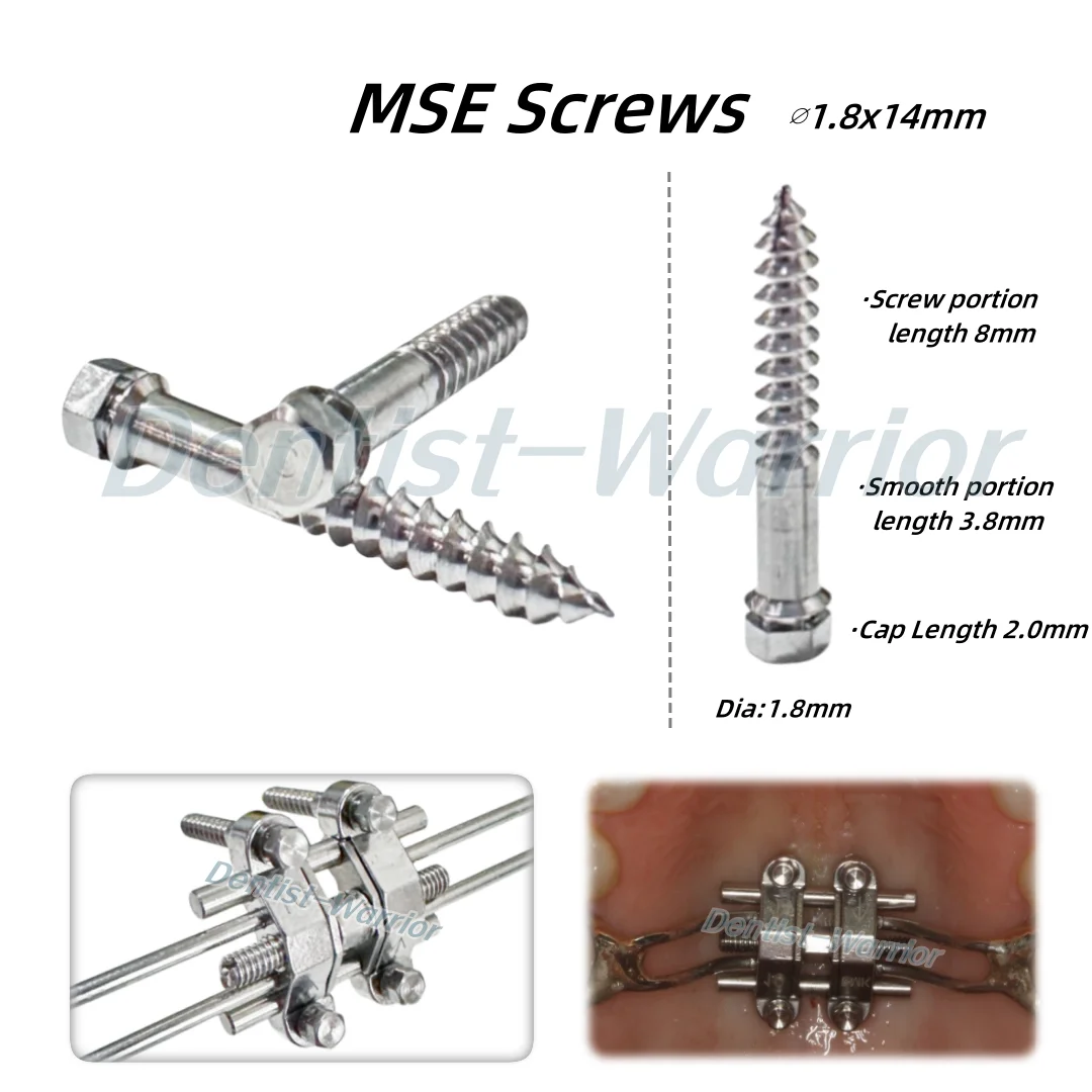 MSE Screws Dental Palatal Expansion Screw Mid Facial Rapid Palatal Split Maxillary Expander 8/10/12mm