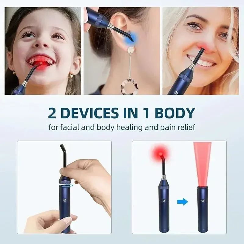 Home Use Red Laser Canker Sore Laser Physiotherapy Led Red Light Physical Therapy Equipment Anti-Inflammatory And Analgesic