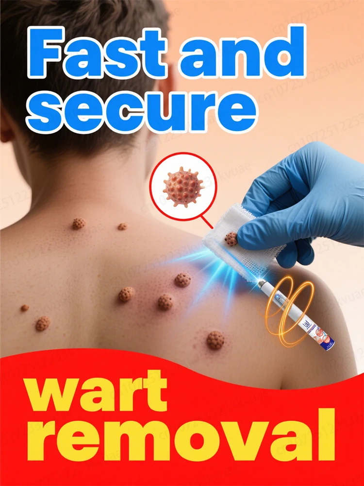 

Quickly remove warts and let beauty no longer be limited!
